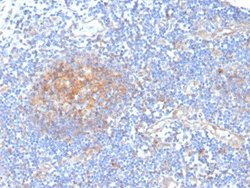 Aldo-keto Reductase 1C1/AKR1C1 Antibody (CPTC-AKR1C1-2) - Azide and BSA